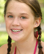 girl wearing braces